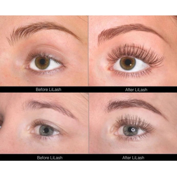 Lilash Eyelash Serum